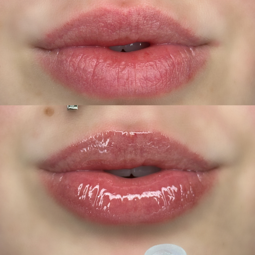 Ultra Glacier Jelly Lip Mask