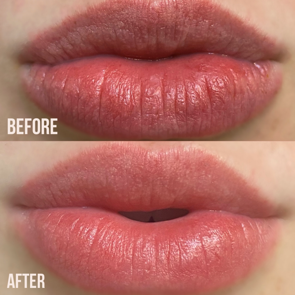 Pucker Up Jelly Lip Mask